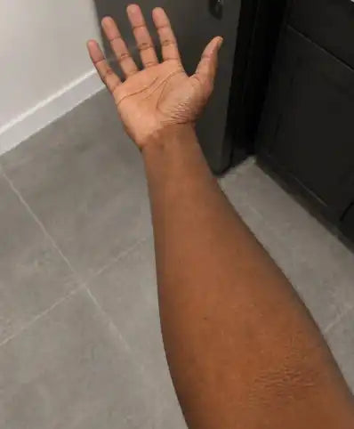 After 45 days!